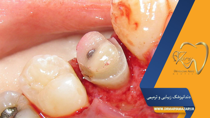 دکتر مربم آذری | جراح دندانپزشک در اصفهان |  دندانپزشک زیبایی ترمیمی اصفهان 