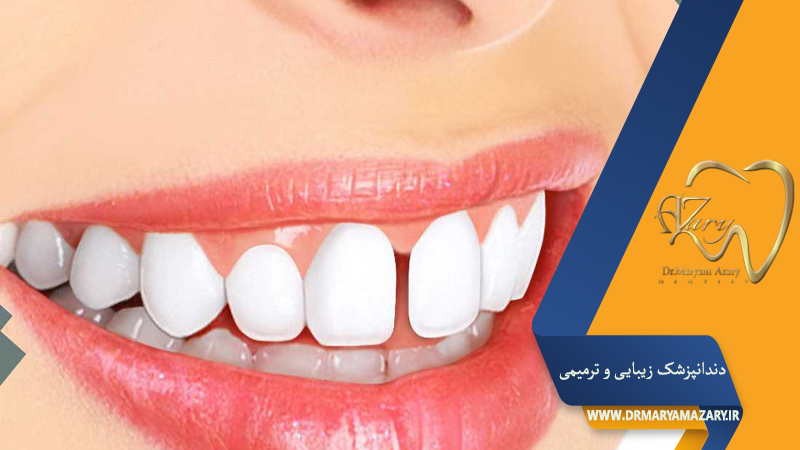 دکتر مربم آذری | جراح دندانپزشک در اصفهان |  دندانپزشک زیبایی ترمیمی اصفهان 