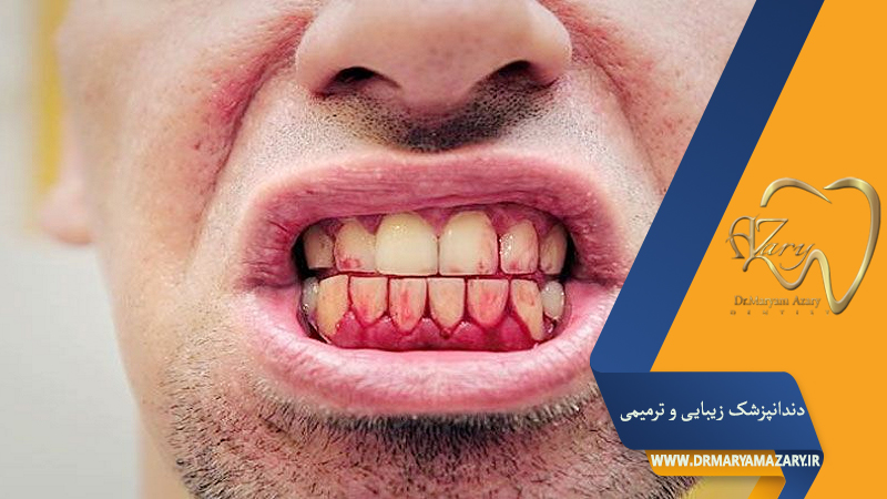 دکتر مربم آذری | جراح دندانپزشک در اصفهان |  دندانپزشک زیبایی ترمیمی اصفهان 