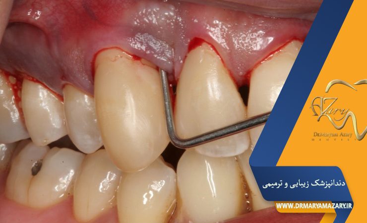 دکتر مربم آذری | جراح دندانپزشک در اصفهان | دندانپزشک زیبایی ترمیمی اصفهان