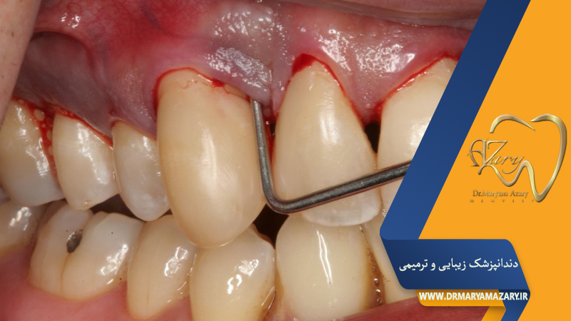 دکتر مربم آذری | جراح دندانپزشک در اصفهان |  دندانپزشک زیبایی ترمیمی اصفهان 