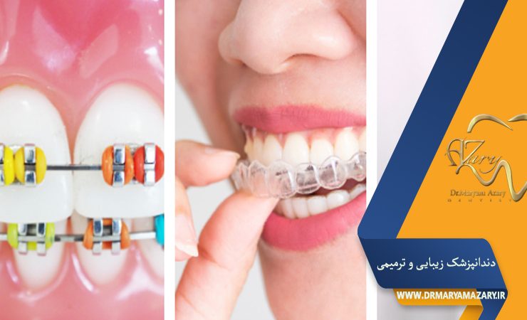 دکتر مربم آذری | جراح دندانپزشک در اصفهان | دندانپزشک زیبایی ترمیمی اصفهان