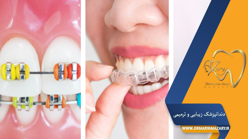 دکتر مربم آذری | جراح دندانپزشک در اصفهان |  دندانپزشک زیبایی ترمیمی اصفهان 