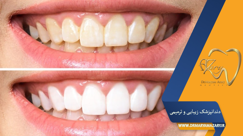 دکتر مربم آذری | جراح دندانپزشک در اصفهان |  دندانپزشک زیبایی ترمیمی اصفهان 