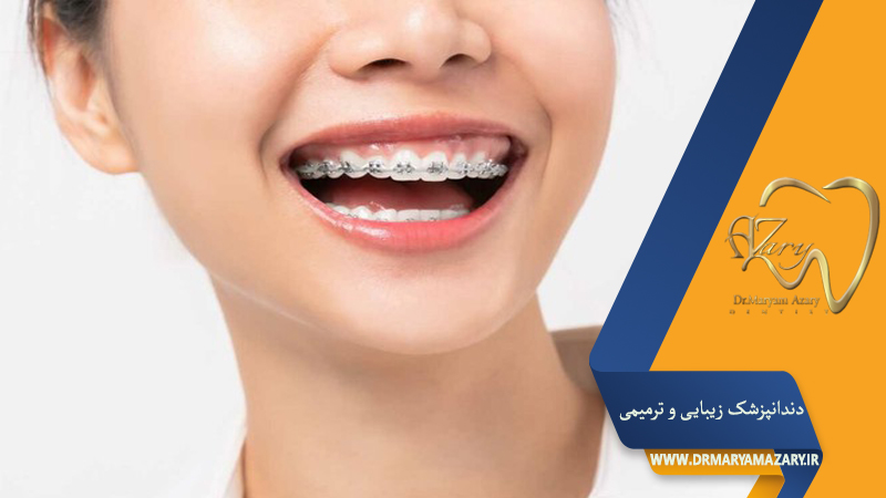 دکتر مربم آذری | جراح دندانپزشک در اصفهان |  دندانپزشک زیبایی ترمیمی اصفهان 