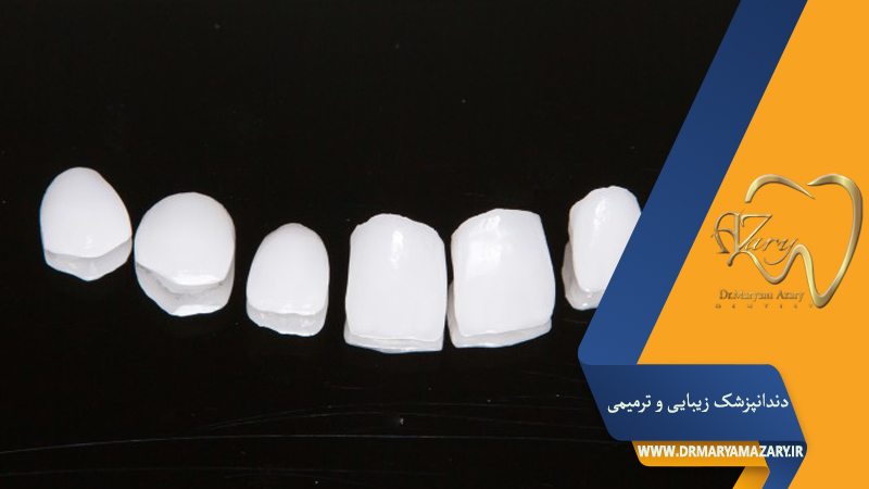 دندانپزشک زیبایی ترمیمی اصفهان | دکتر مریم آذری