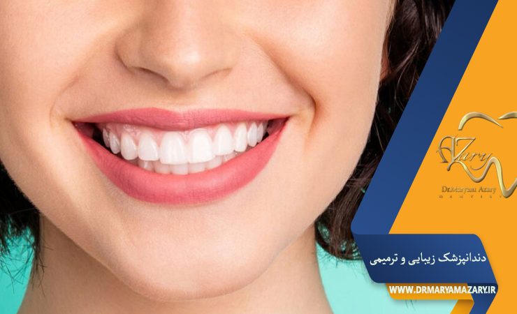 دندانپزشک زیبایی ترمیمی اصفهان | دکتر مریم آذری