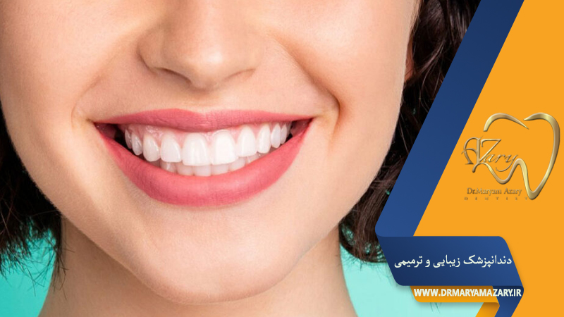 دندانپزشک زیبایی ترمیمی اصفهان | دکتر مریم آذری
