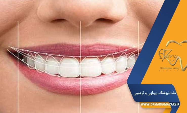 دندانپزشک زیبایی ترمیمی اصفهان | دکتر مریم آذری