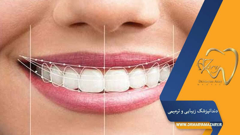 دندانپزشک زیبایی ترمیمی اصفهان | دکتر مریم آذری