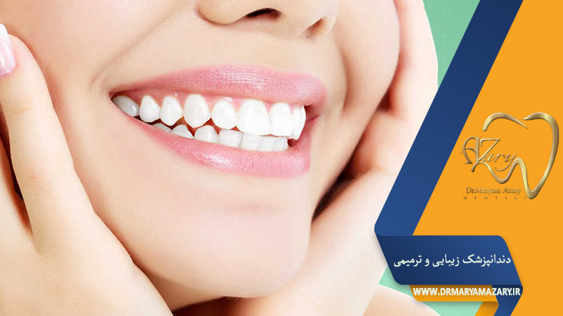 دندانپزشک زیبایی ترمیمی اصفهان | دکتر مریم آذری