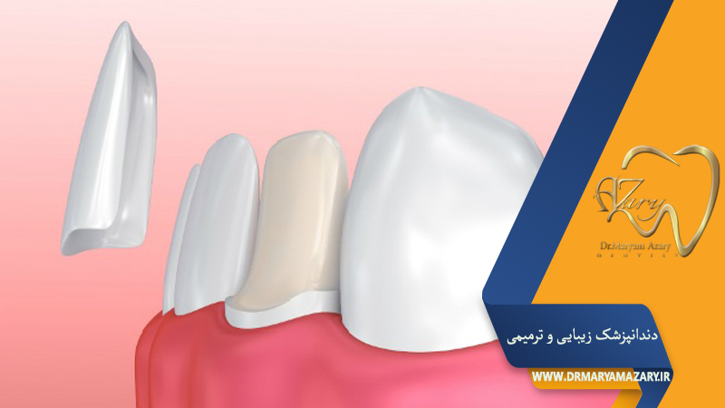 دندانپزشک زیبایی ترمیمی اصفهان 