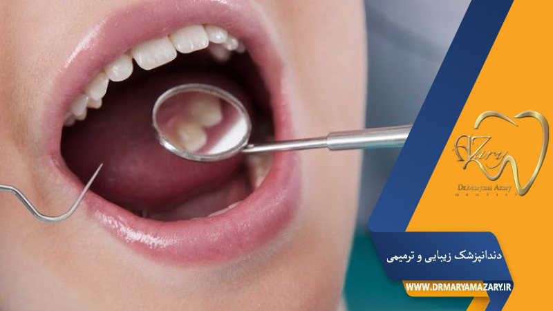دندانپزشک زیبایی ترمیمی اصفهان 