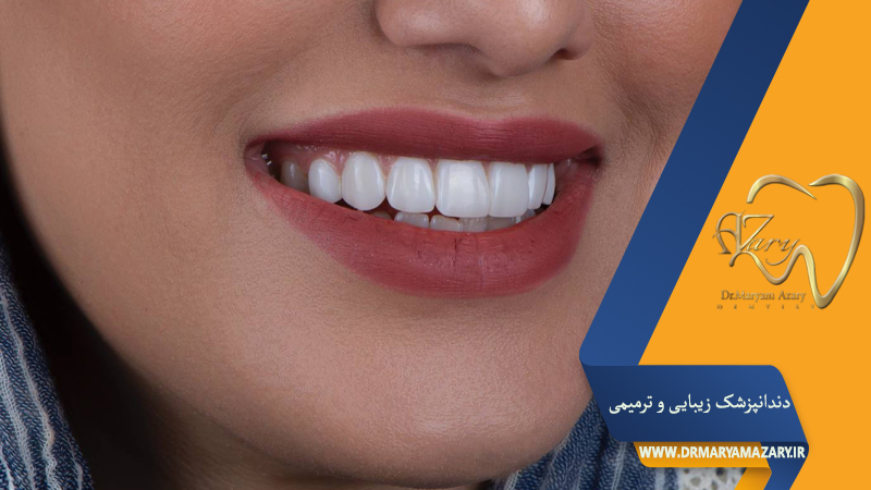بهترین دندانپزشک زیبایی و ترمیمی در اصفهان | دکتر خوب روکش دندان در اصفهان