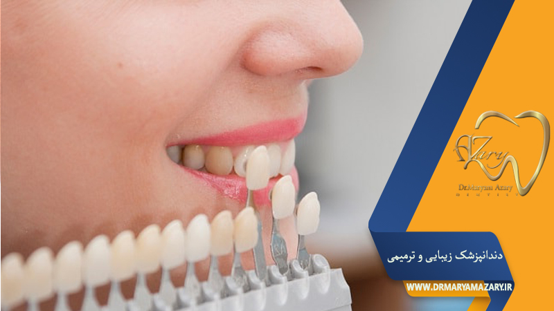 دندانپزشک زیبایی ترمیمی اصفهان 