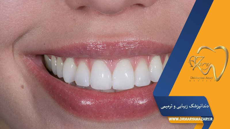 بهترین دندانپزشک زیبایی و ترمیمی در اصفهان | دکتر خوب روکش دندان در اصفهان