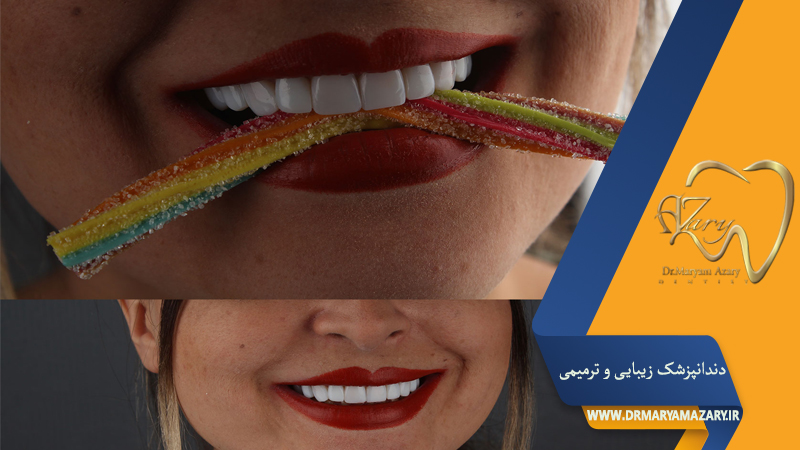 دندانپزشک زیبایی ترمیمی اصفهان  | دکتر مریم آذری