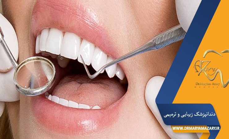 سن ایده آل گرفتن ونیر