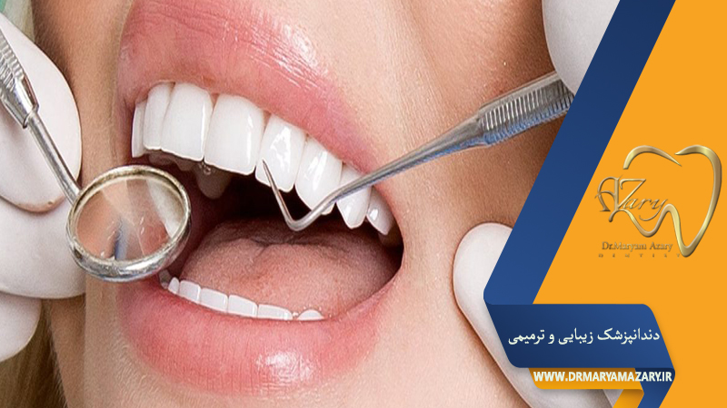 سن ایده آل گرفتن ونیر