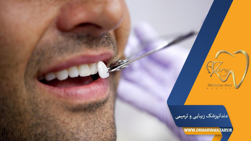 دندانپزشک زیبایی ترمیمی اصفهان  | دکتر مریم آذری