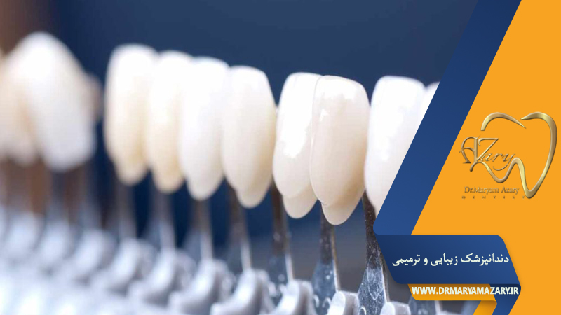 دندانپزشک زیبایی ترمیمی اصفهان  | دکتر مریم آذری
