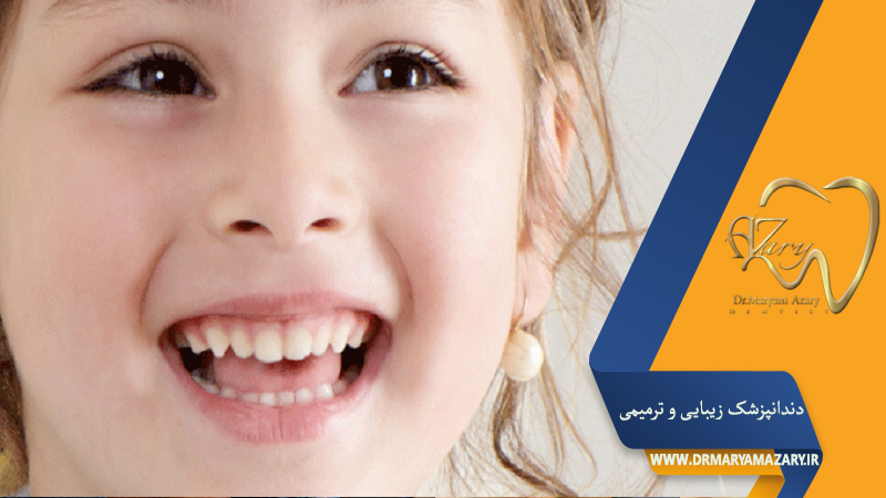 دندانپزشک زیبایی ترمیمی اصفهان  | دکتر مریم آذری