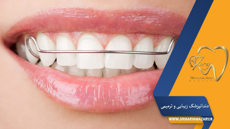 دندانپزشک زیبایی ترمیمی اصفهان  | دکتر مریم آذری