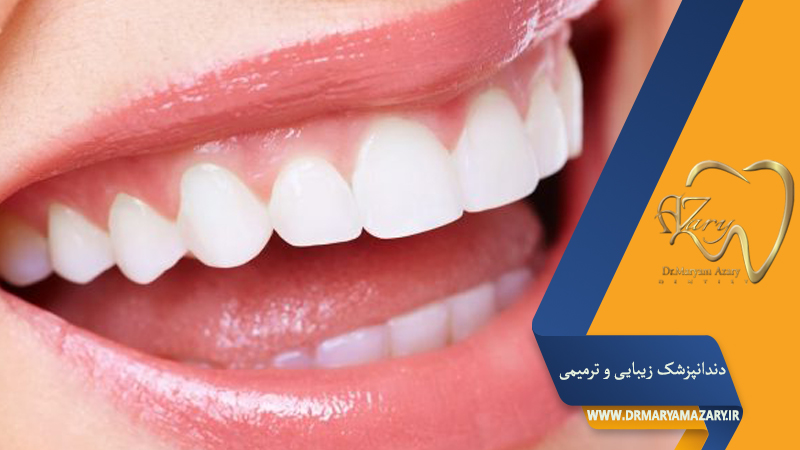 دندانپزشک زیبایی ترمیمی اصفهان  | دکتر مریم آذری