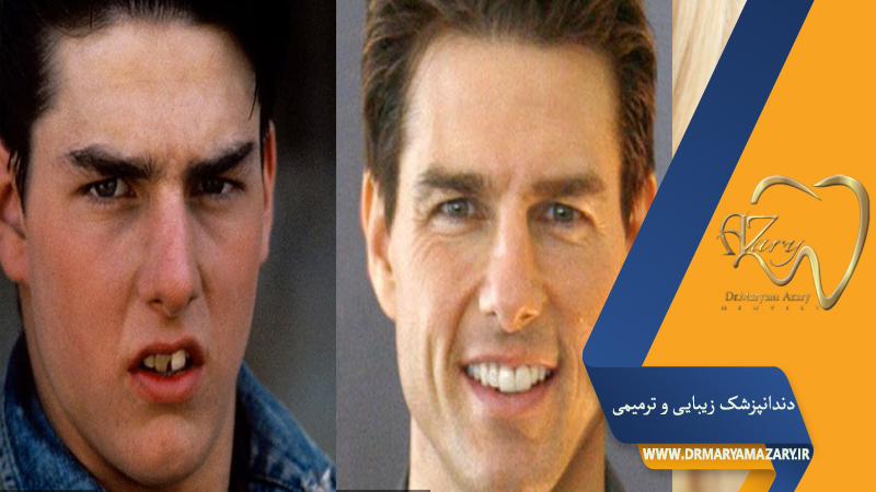 دندانپزشک زیبایی ترمیمی اصفهان  | دکتر مریم آذری