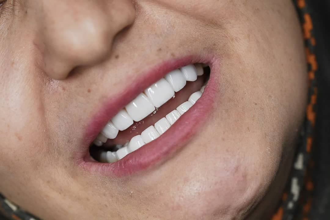 نمونه کاری های دکتر مریم آذری