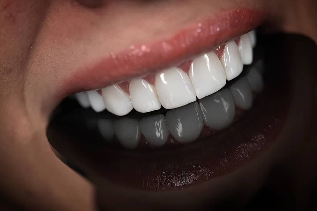 نمونه کاری های دکتر مریم آذری