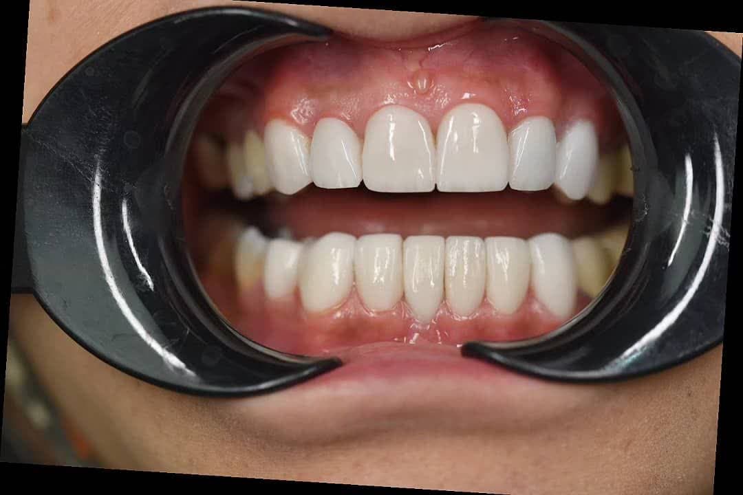 نمونه کاری های دکتر مریم آذری