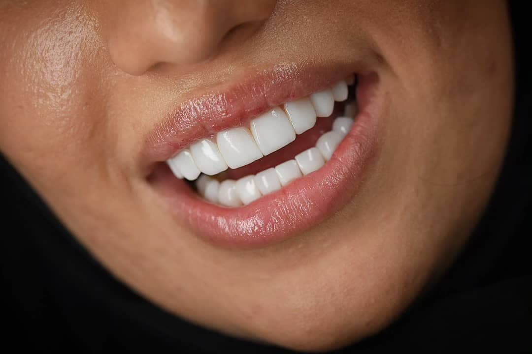 نمونه کاری های دکتر مریم آذری