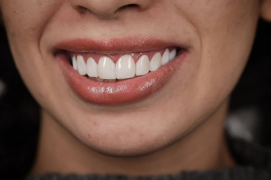 نمونه کاری های دکتر مریم آذری