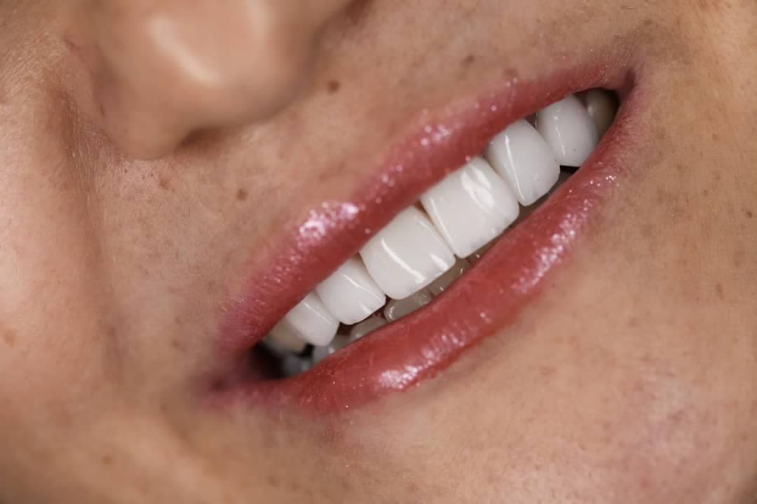 نمونه کاری های دکتر مریم آذری