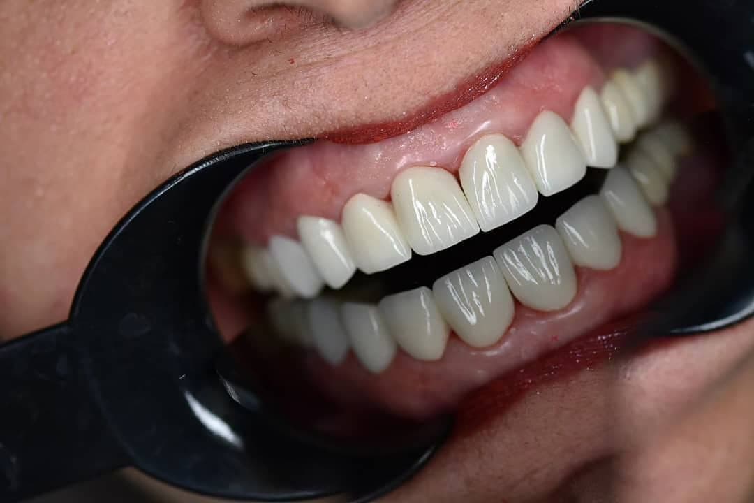 نمونه کاری های دکتر مریم آذری