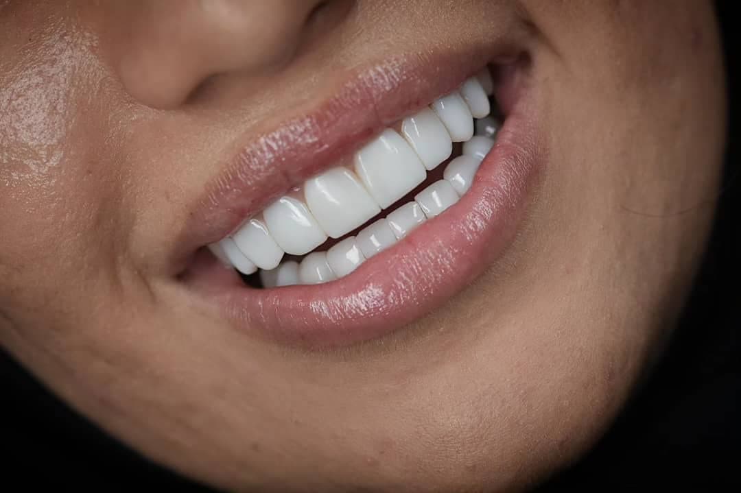 نمونه کاری های دکتر مریم آذری