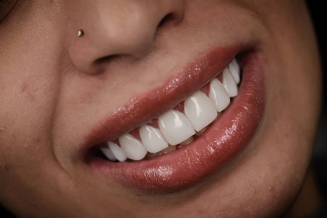 نمونه کاری های دکتر مریم آذری