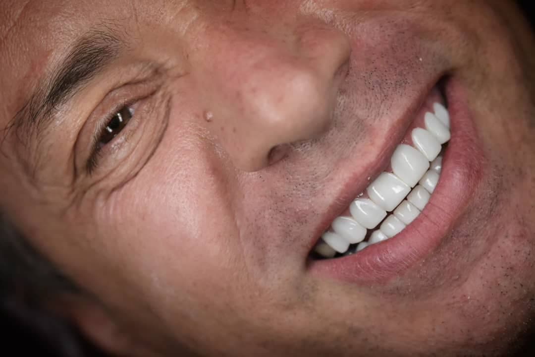 نمونه کاری های دکتر مریم آذری