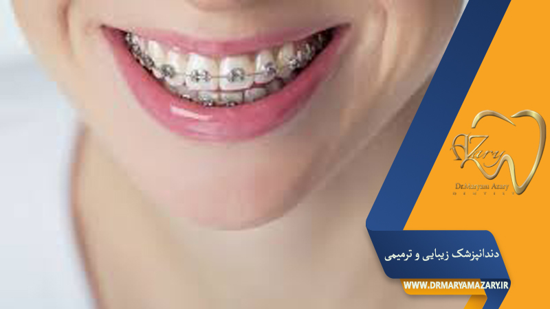 هایفوتراپی در کلینیک تخصصی دکتر سیمین دخت کلانتری معروف ترین متخصص پوست، مو و زیبایی در اصفهان - بهترین متخصص پوست و مو در اصفهان -  هایفوتراپی صورت در اصفهان