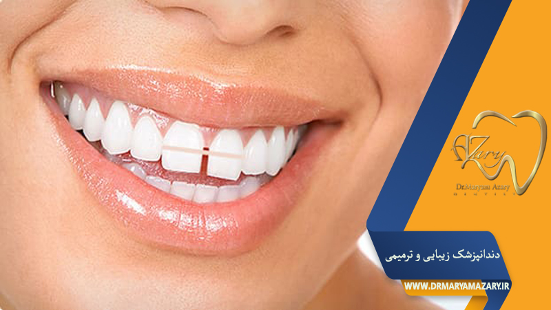 دندانپزشک زیبایی ترمیمی اصفهان  | دکتر مریم آذری