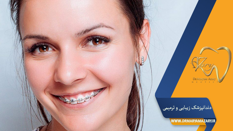 دندانپزشک زیبایی ترمیمی اصفهان  | دکتر مریم آذری