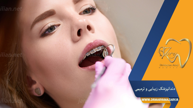 دندانپزشک زیبایی ترمیمی اصفهان  | دکتر مریم آذری