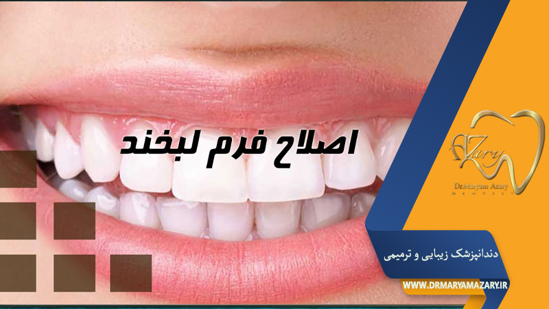 دندانپزشک زیبایی ترمیمی اصفهان  | دکتر مریم آذری