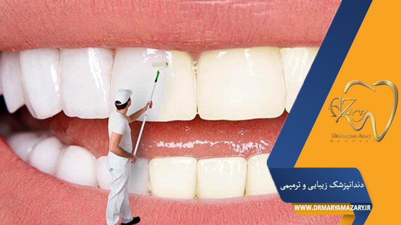 زرد شدن کامپوزیت