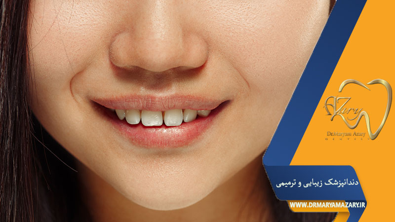 دیاستما دندان