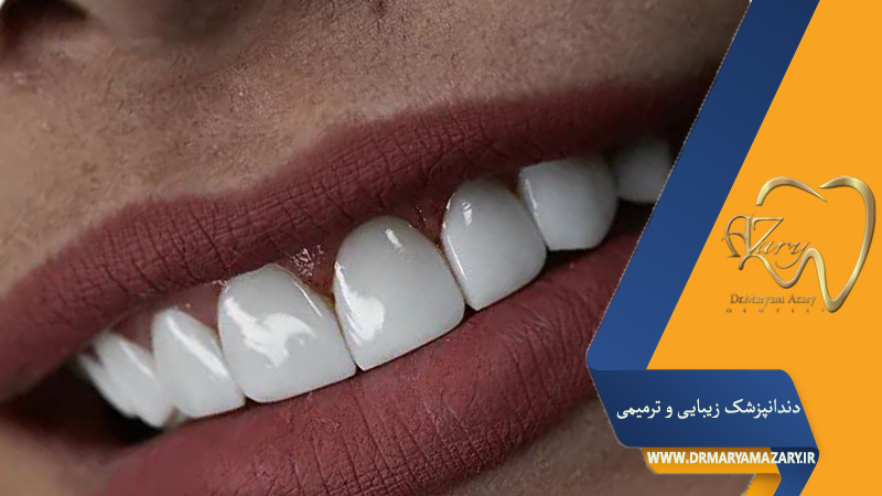 لمینت دندان در دوران بارداری