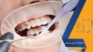 تأثیر سیگار بر سلامت دندان‌ها و راهکارهای پیشگیری