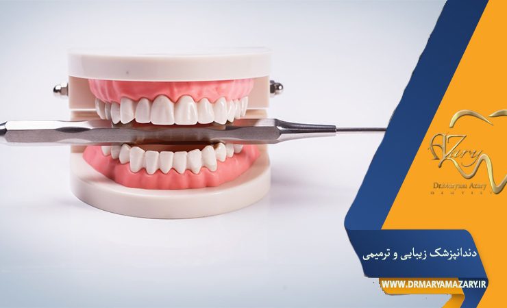 روشهای نوین در درمان بیماریهای لثه و راهکارهای پیشگیری از آن