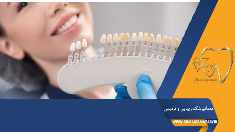 تفاوت لمینت و کامپوزیت